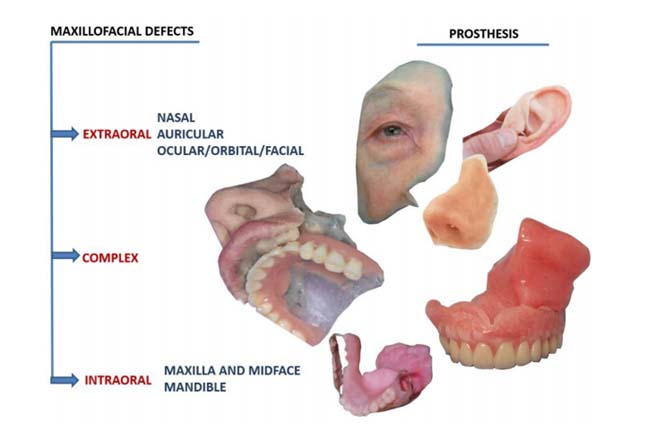 oral cancer specialist in ahmedabad 