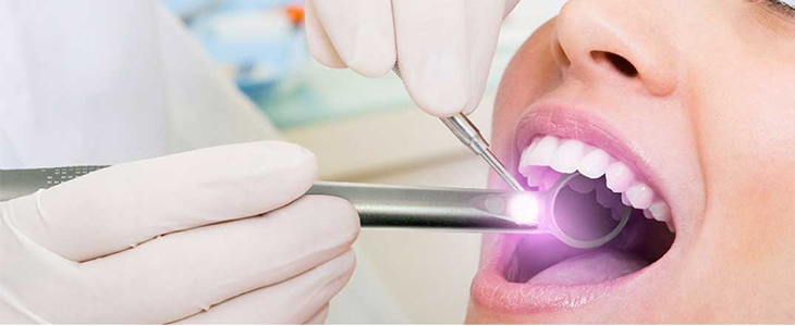 Root Canal Treatment in ahmedabad 